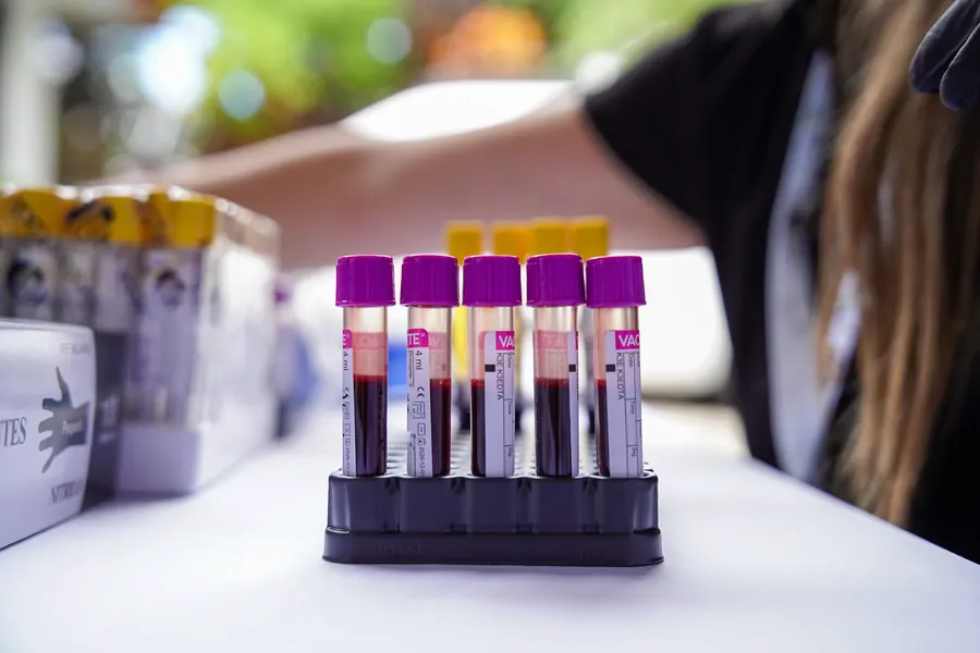Tubos de muestra con tapas de colores listos para el análisis