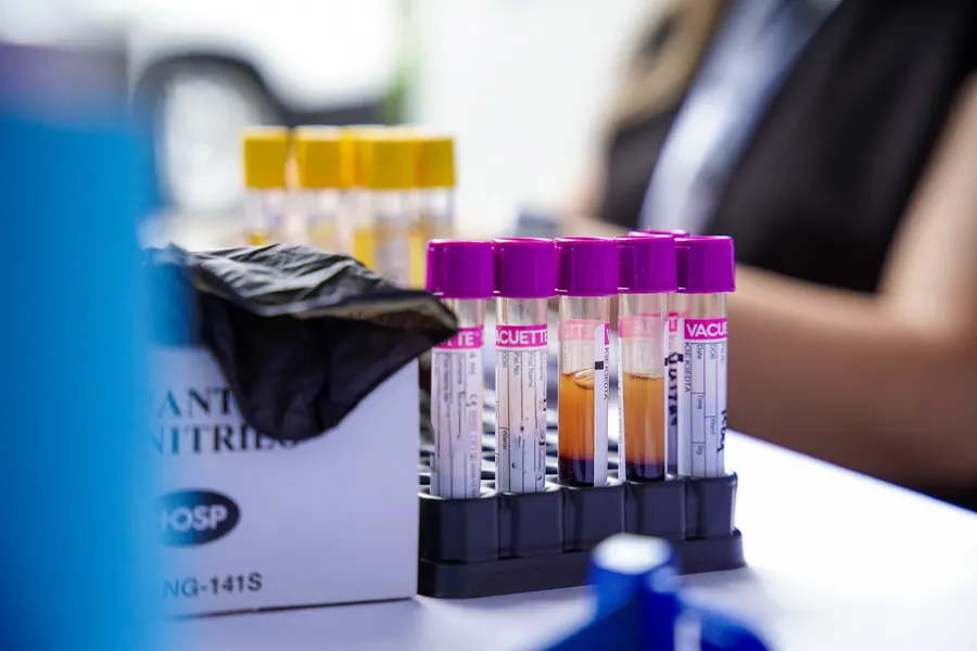 Tubos de muestra rotulados y ordenados en su gradilla